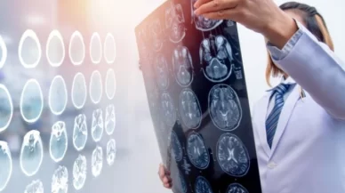 What Are the 4 Types of Traumatic Brain Injuries?