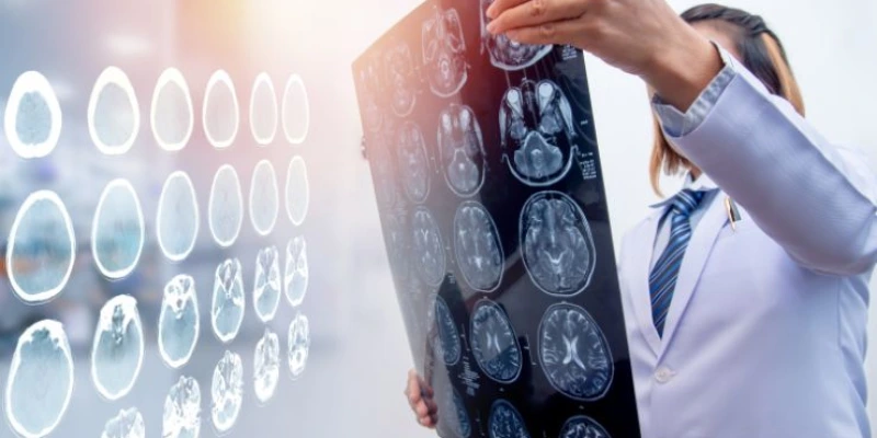 What Are the 4 Types of Traumatic Brain Injuries?