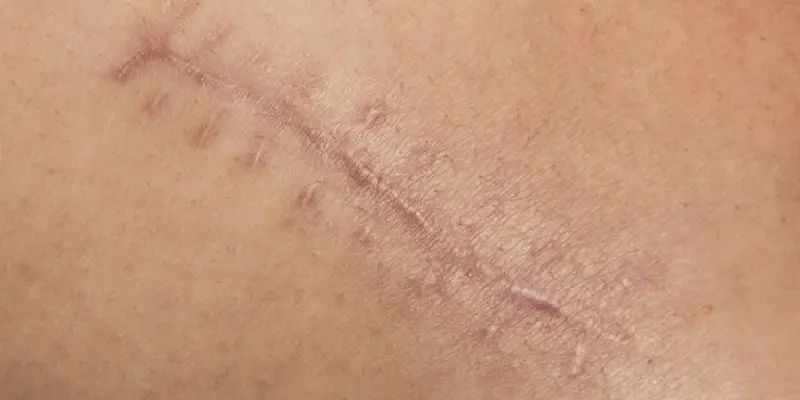 Charlotte Scarring Lawyer-image